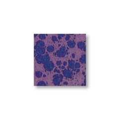 Anemone – brillant